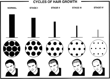 12 Fast Hair Growth Secrets To Triple Your Hair Growth ...